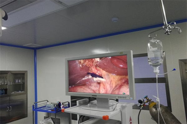 腹腔镜监视器